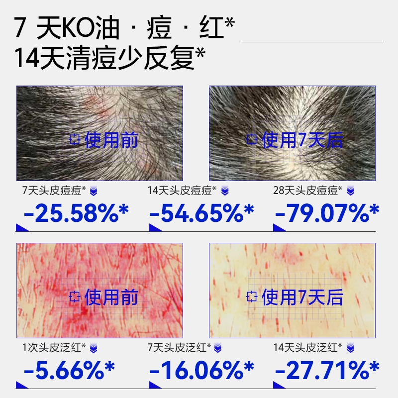 EHD 500ml*1500*2