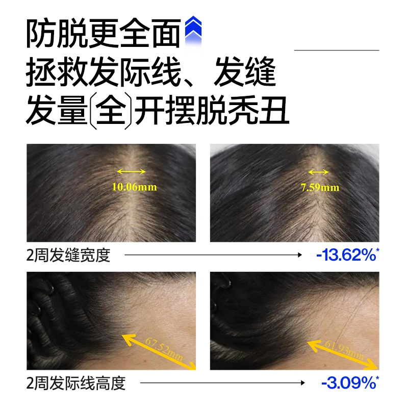 EHD 500ml500*2