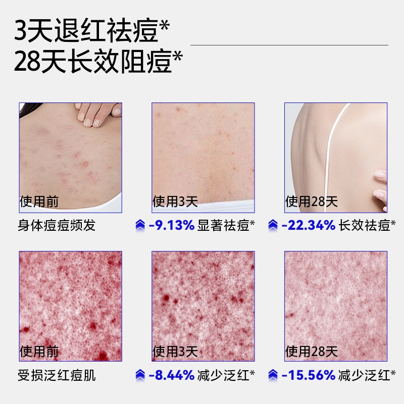 EHD 500ml*1500*2