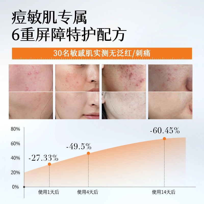 初夏堂初夏堂胶态硫祛痘精华液 保湿滋润舒缓补水