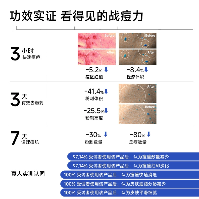 阳菲净颜祛痘精华液 保湿去角质