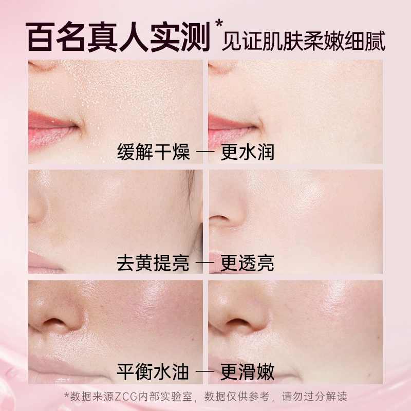 ZCG