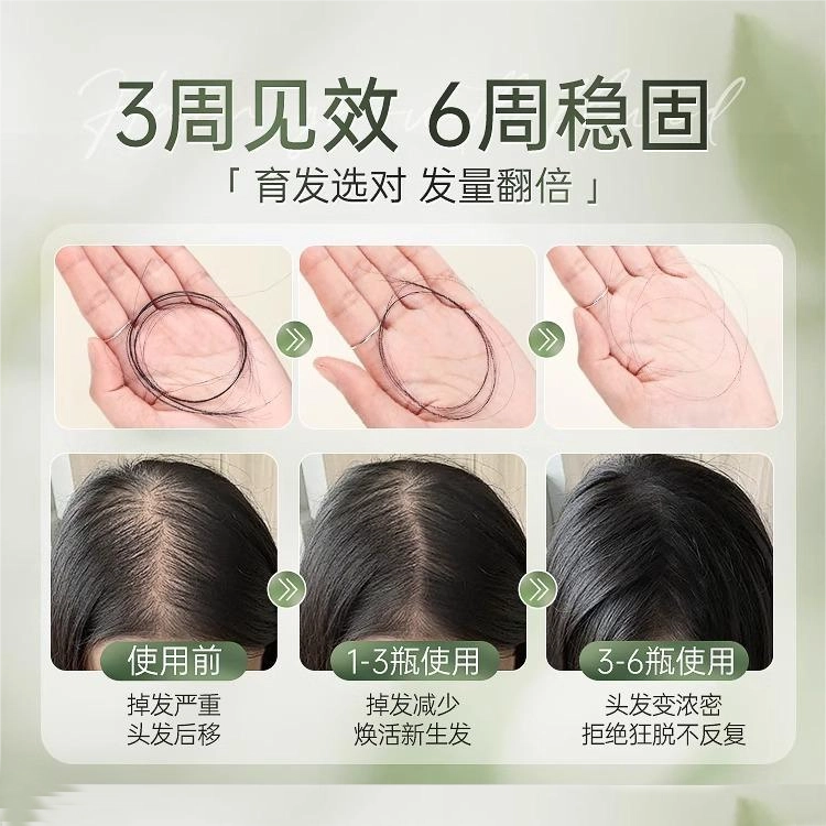 韩方五谷 增发密发际线养头皮快速增长液 育发液护发营养液