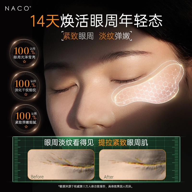 NACO 1020