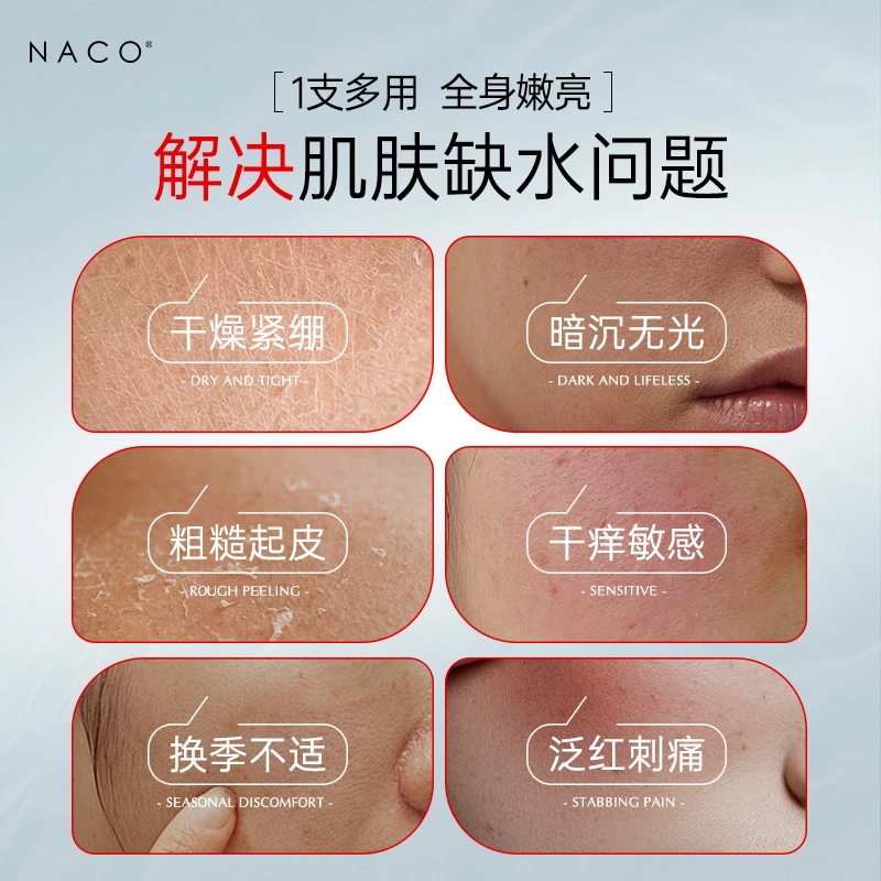 NACO