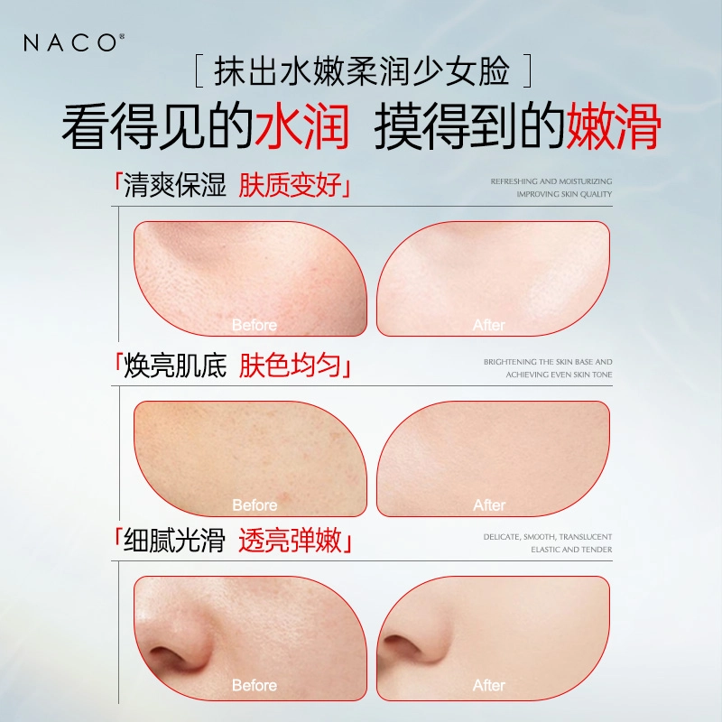 NACO