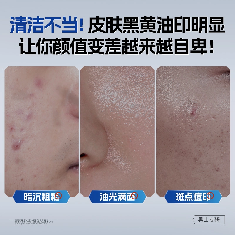 左颜右色 寡肽原液改善痘痘肌男生护肤套装美白洗面奶秋冬面霜组合 精华液 保湿滋润 任何肤质