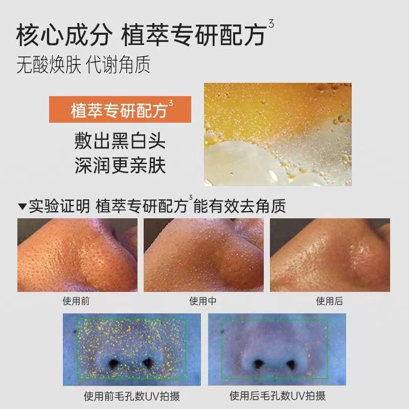 雅莎尔 焕肤毛孔收敛水 保湿祛痘控油