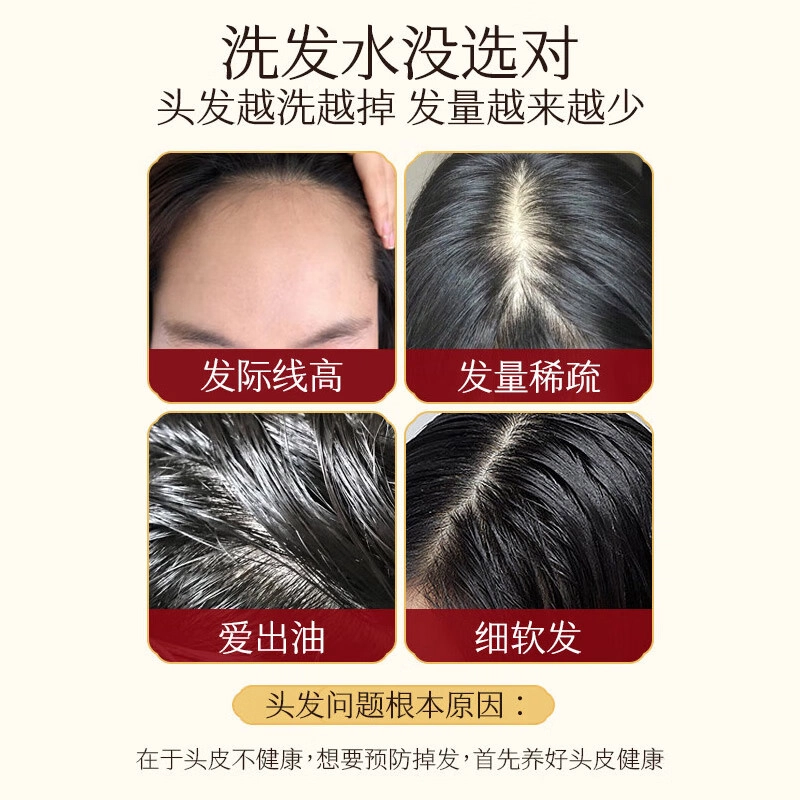高缇雅 防脱固发洗发水+精华液套装 滋润头皮 丰盈蓬松