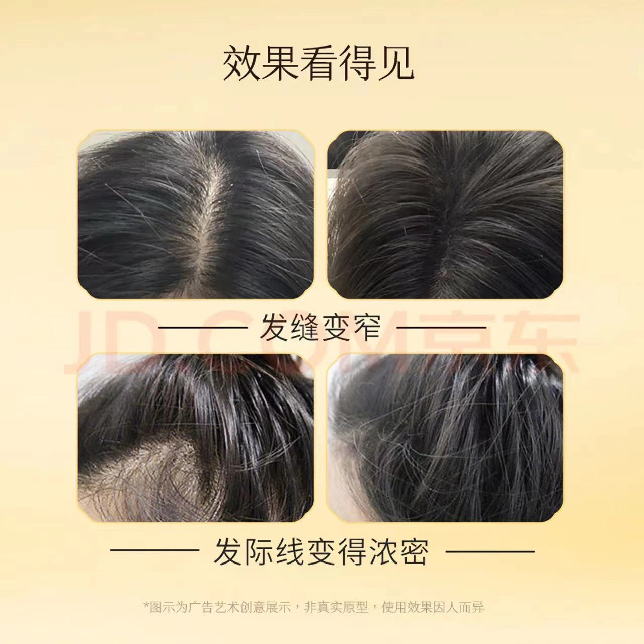 高缇雅生姜防脱固发精华液 舒缓头皮 稳固发根发际线 养发精华 礼盒装