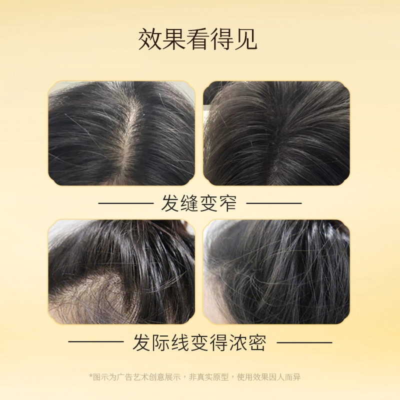 高缇雅 防脱固发洗发水+精华液套装 滋润头皮 丰盈蓬松