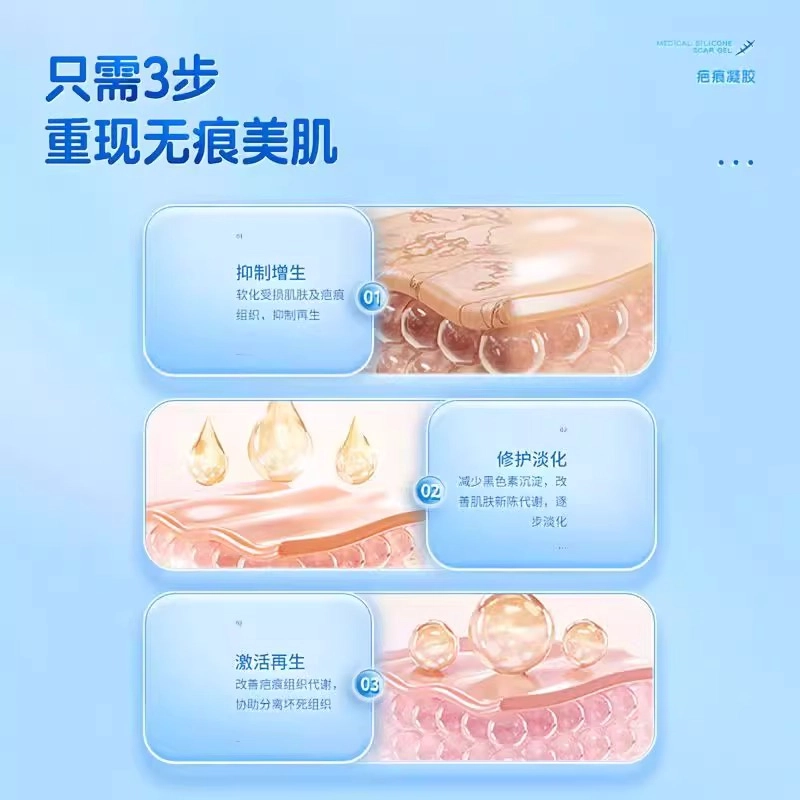 20g