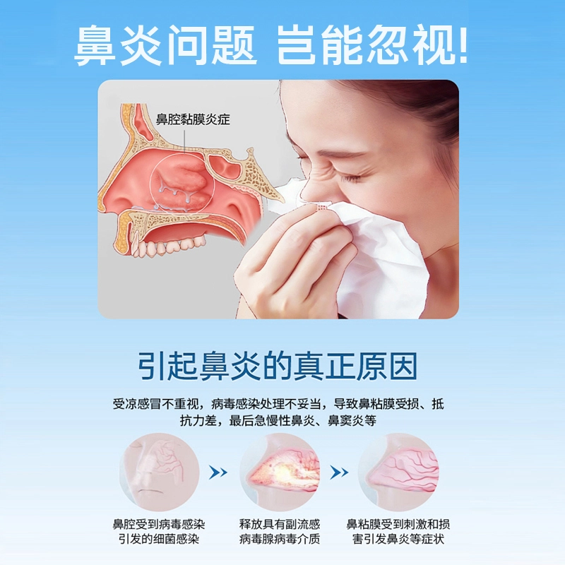 内廷上用 医用过敏鼻炎凝胶鼻腔护理 打喷嚏鼻粘膜感染鼻粘膜充血