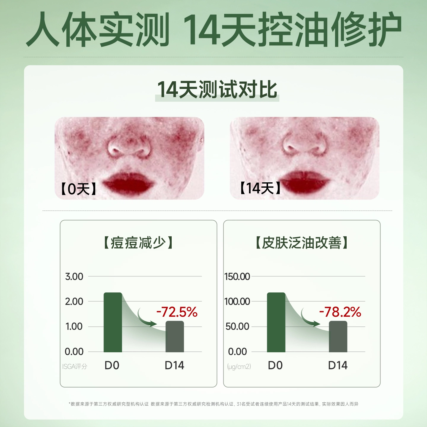 妮雅丝 益生菌控油祛痘护肤套装 保湿