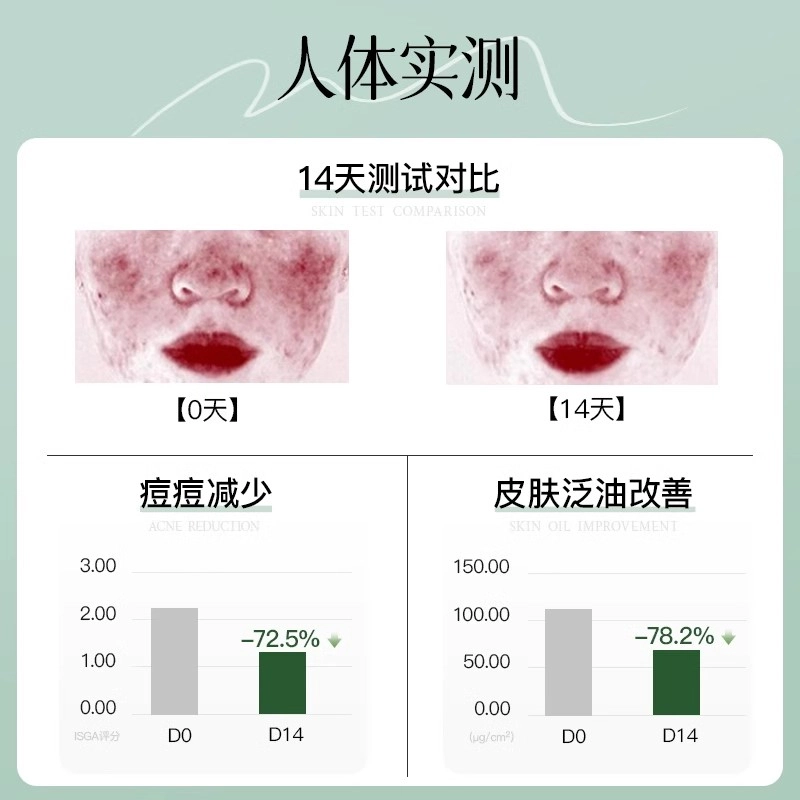妮雅丝 益生菌乳酸杆菌水乳套装 修护控油清爽祛痘维稳舒缓