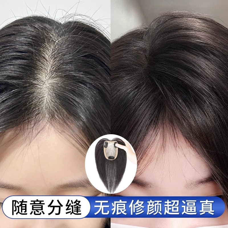 天空树 双递针蚕丝网补发片 拯救发际线遮盖宽发缝