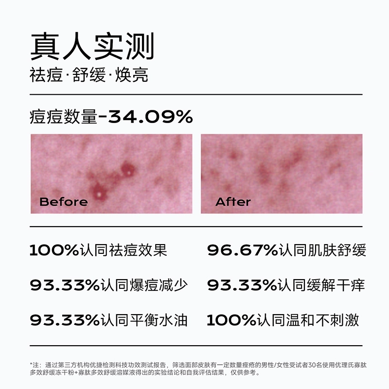 优理氏 寡肽多效冻干粉玻尿酸水光盈润 护肤套盒 保湿祛痘改善暗沉