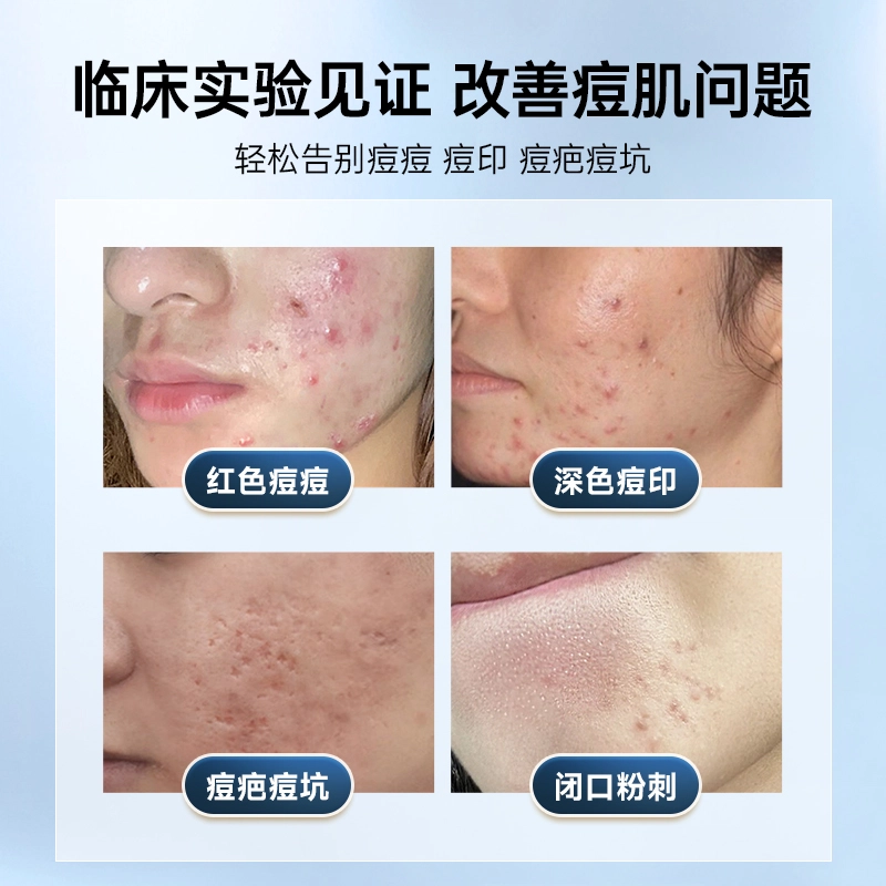 OHBT 60g