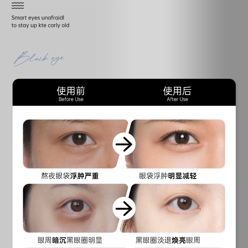 水木花草玻色因眼霜淡化细纹抗皱抗老 改善眼周暗沉