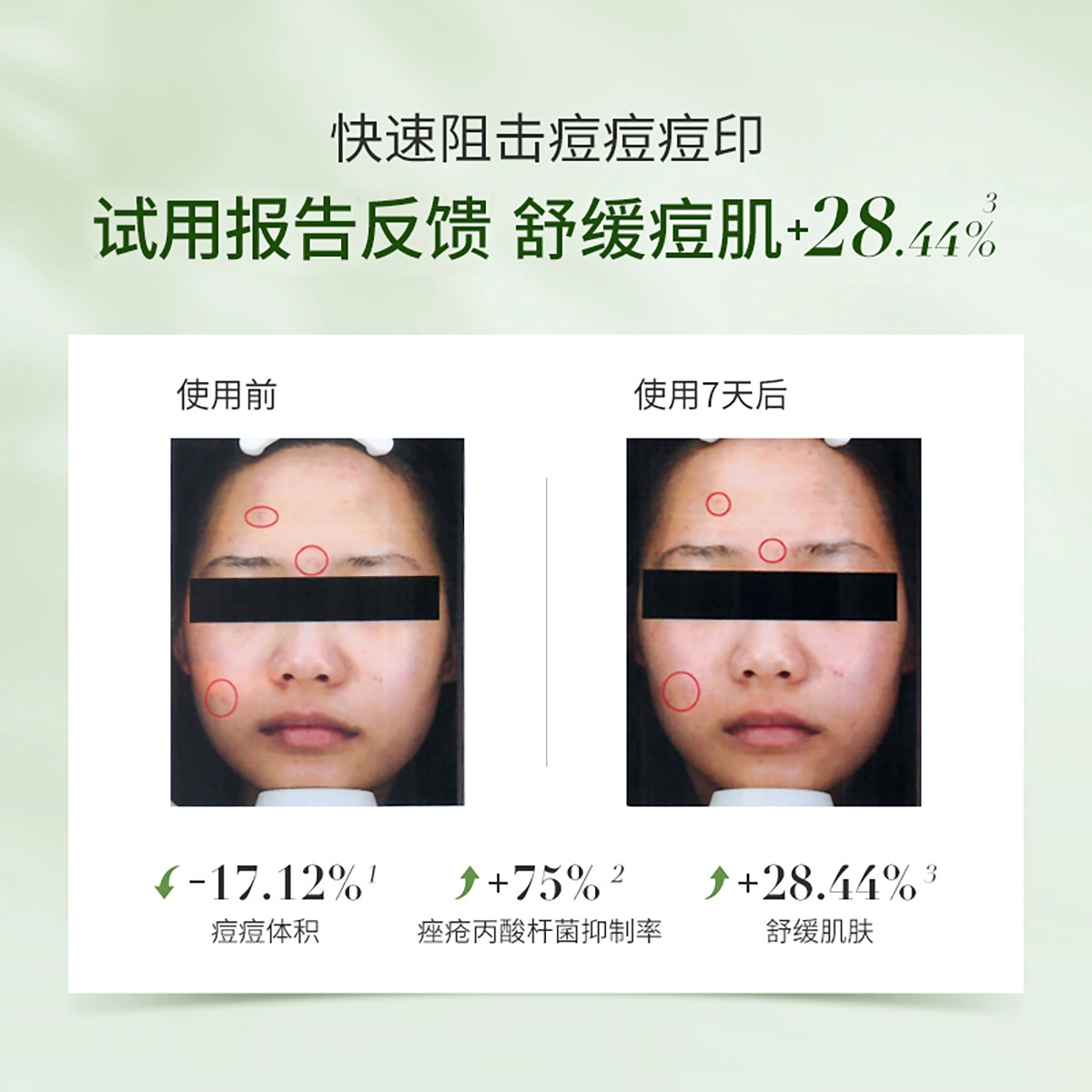 孔凤春 氨基酸祛痘双管护肤套装 淡痘印去黑眼圈去角质控油收缩毛孔