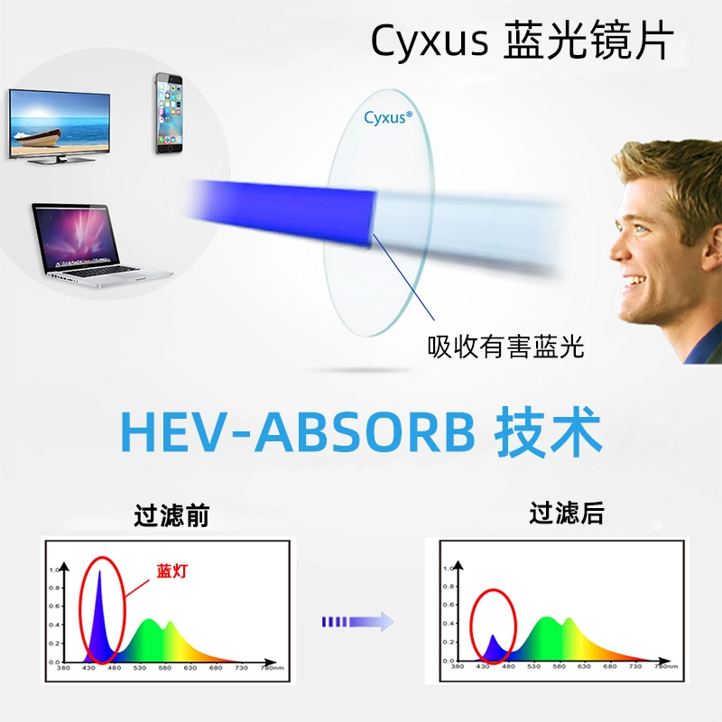CYXUS
