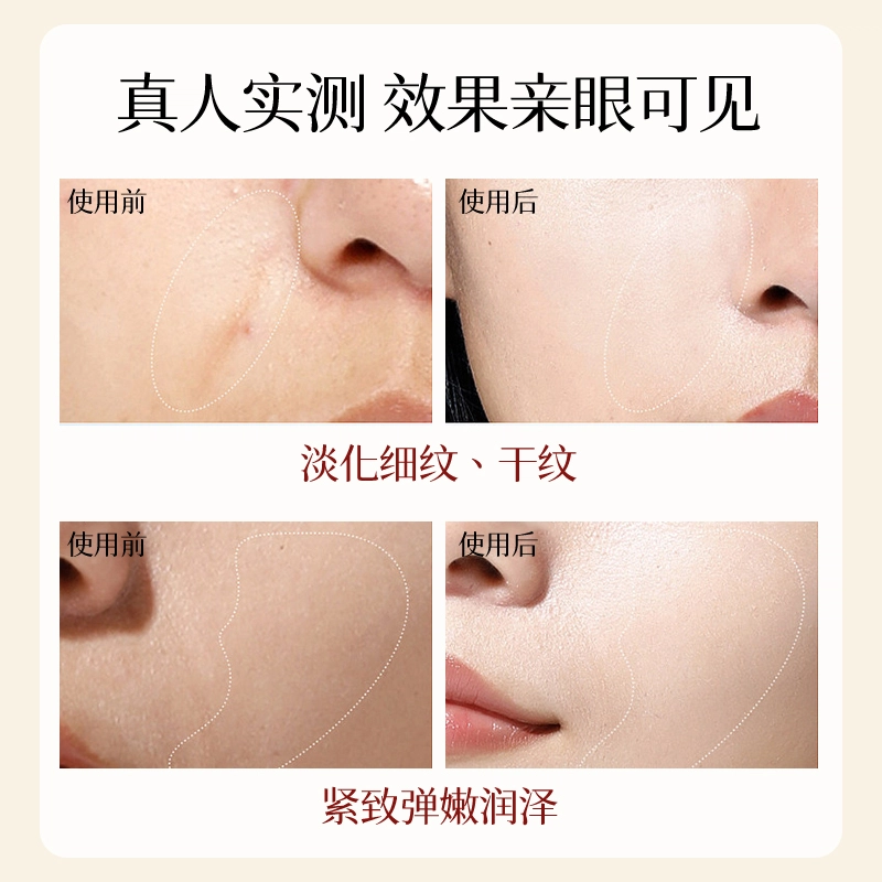 25ml*10