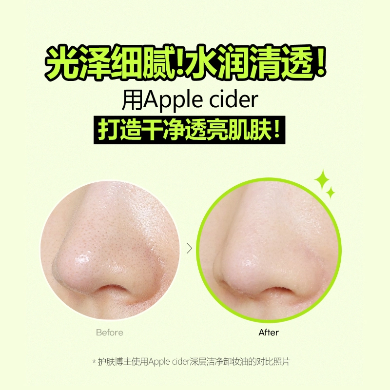 艾藜儿 苹果醋深层清洁温和卸妆油 滋润清爽