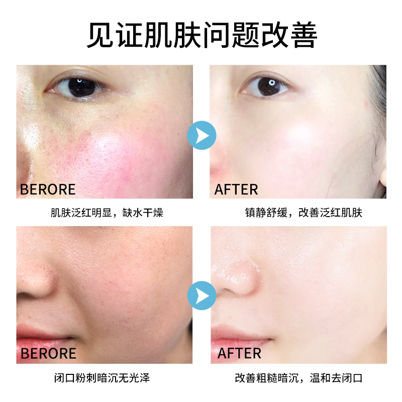 嘉兰杜汀 舒缓保湿爽肤水+舒缓保湿乳液套组 保湿滋润
