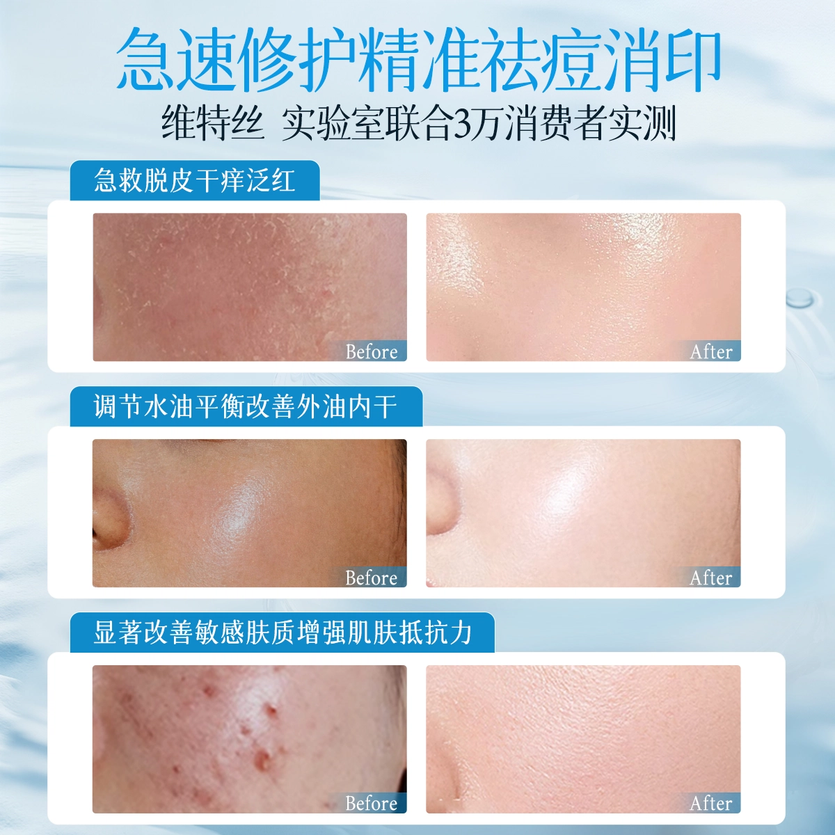 维特丝  高保湿舒缓面霜爆水霜 秋冬换季干燥起皮修护泛红急救紧致清爽淡化痘印 抗氧化提亮滋润维稳补水 改善卡粉斑驳