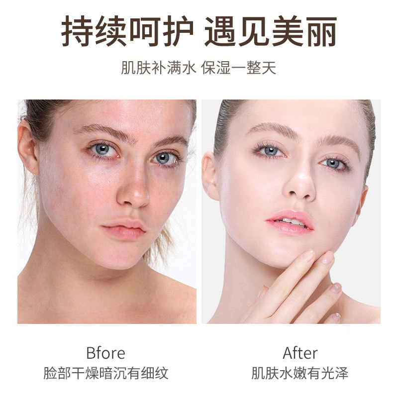 肌琳莎 二裂酵母柔润嫩肤护肤套装 保湿补水 五件套
