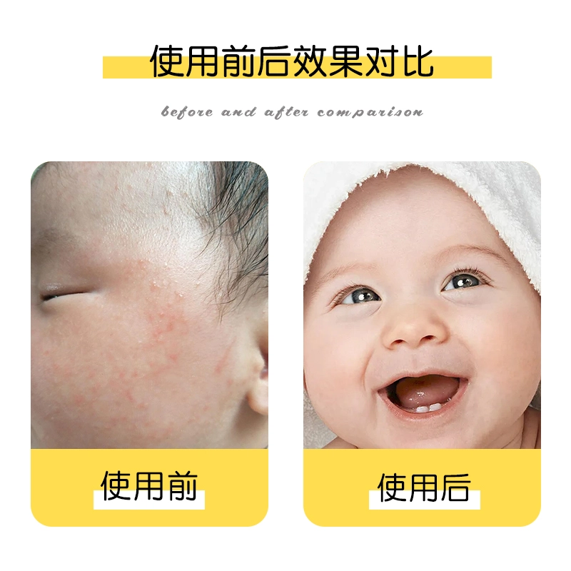 嘟嘟宝贝 秋冬护肤套装 秋冬换季宝宝补水保湿改善肌肤干裂状态丝滑牛奶面霜滋润嫩肌身体乳果味儿童润唇膏组合