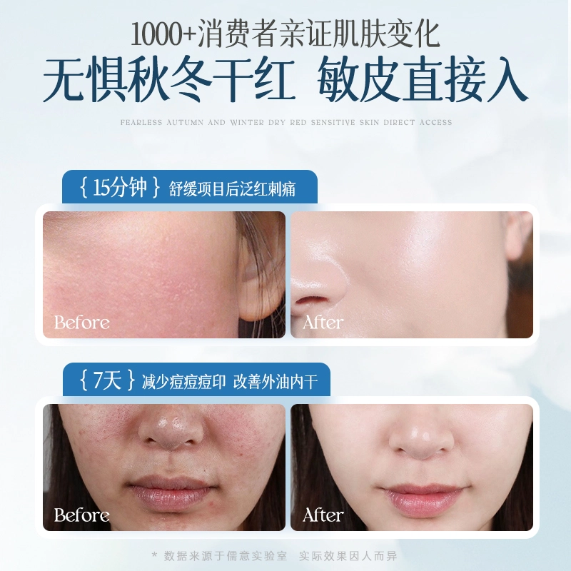 B5 100ml+100ml