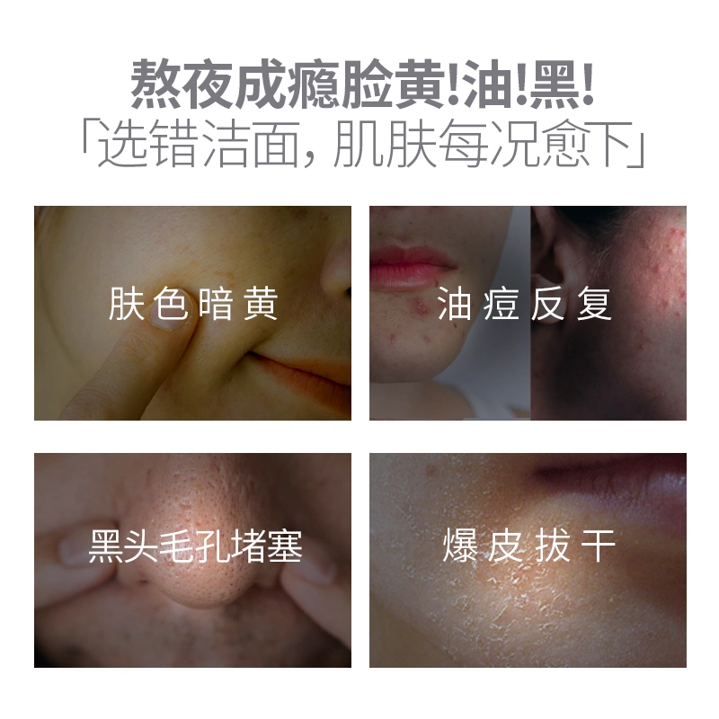 黛伦莎 氨基酸洗面奶 提亮去角质控油清洁祛粉刺