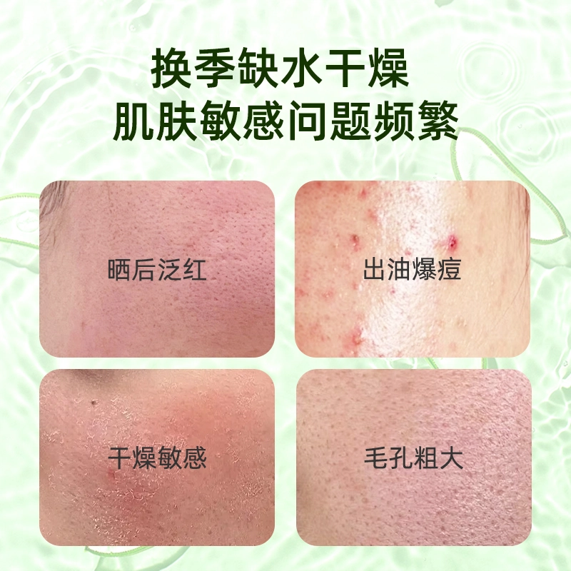 黛伦莎 晒后护理养肤套装 保湿修护提亮晒后修复清爽滋润维稳补水 芦荟胶+黄芪面膜两件套