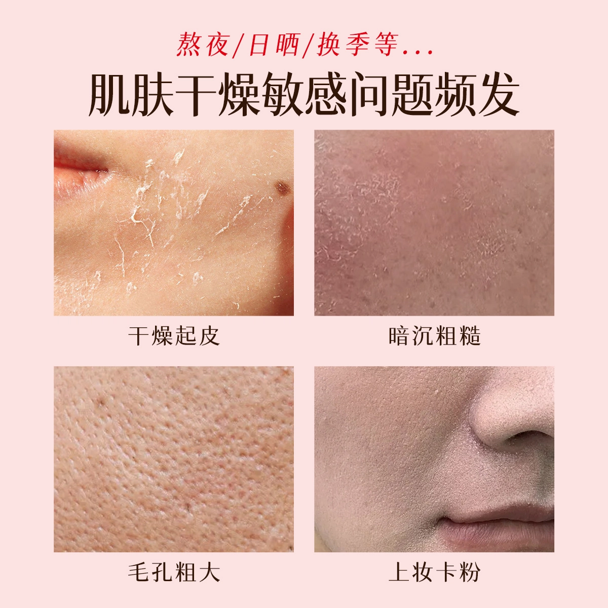 婷美 舒缓护肤套装 保湿补水 深层修护滋润改善干燥
