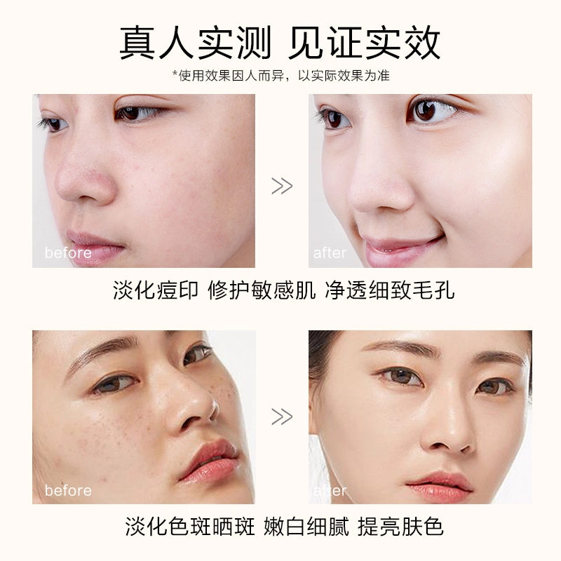 20ml+140ml+120g