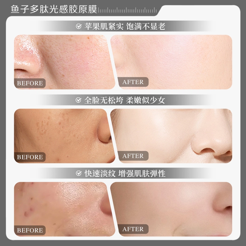 瑜然美 鱼子多肽光感胶原涂抹面膜补水保湿滋润肌肤紧致提亮肤色 保湿滋润紧致补水 多种肤质敏感性肤质混合型肤质