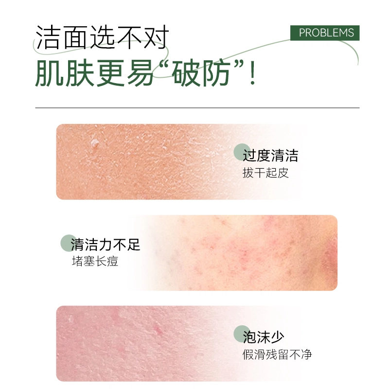 倍膳健 氨基酸洗面奶 去黑头控油收缩毛孔清洁清爽祛痘