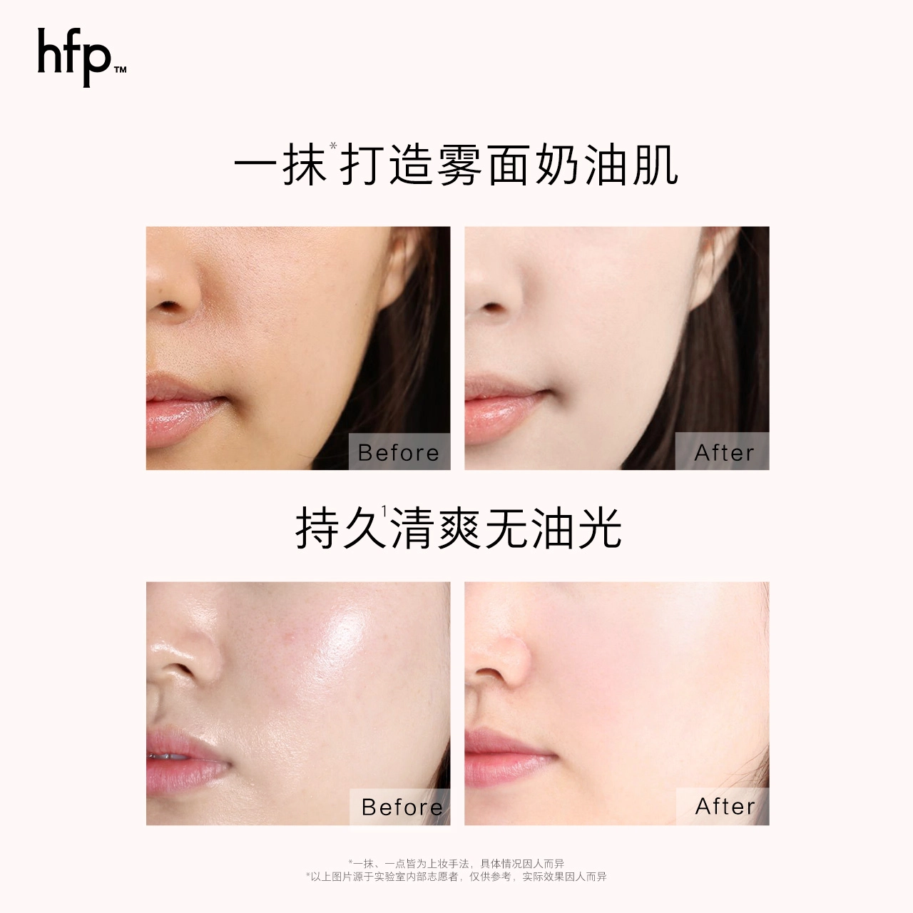 HFP