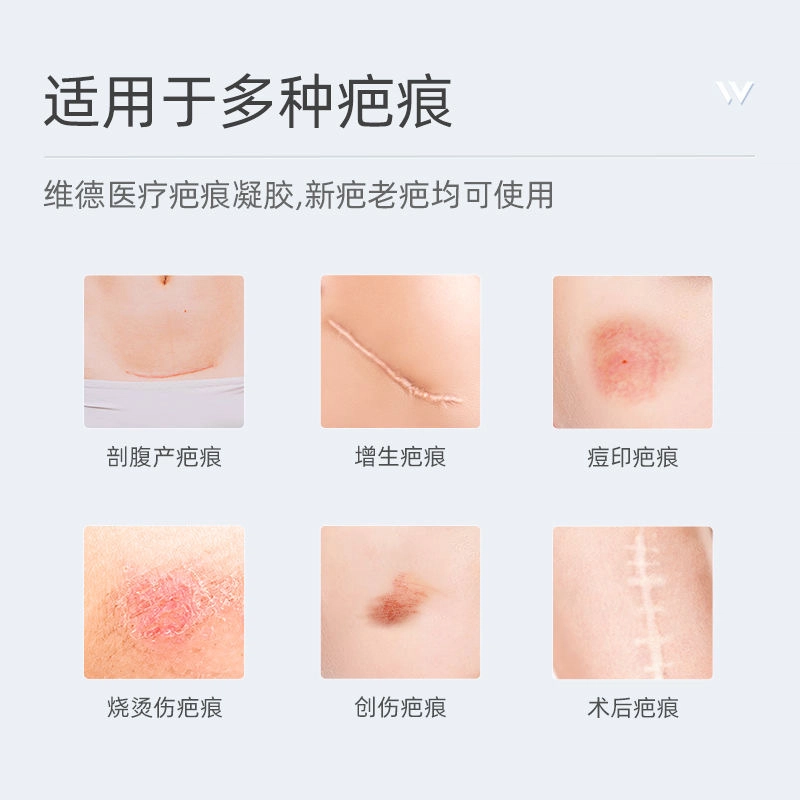 维德医疗 医用疤痕凝胶 除菌 术后增生儿童烧伤痘印疤痕 祛疤凝胶