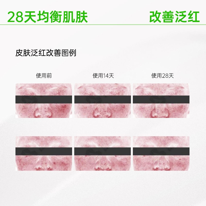 VT 50 2ml*7