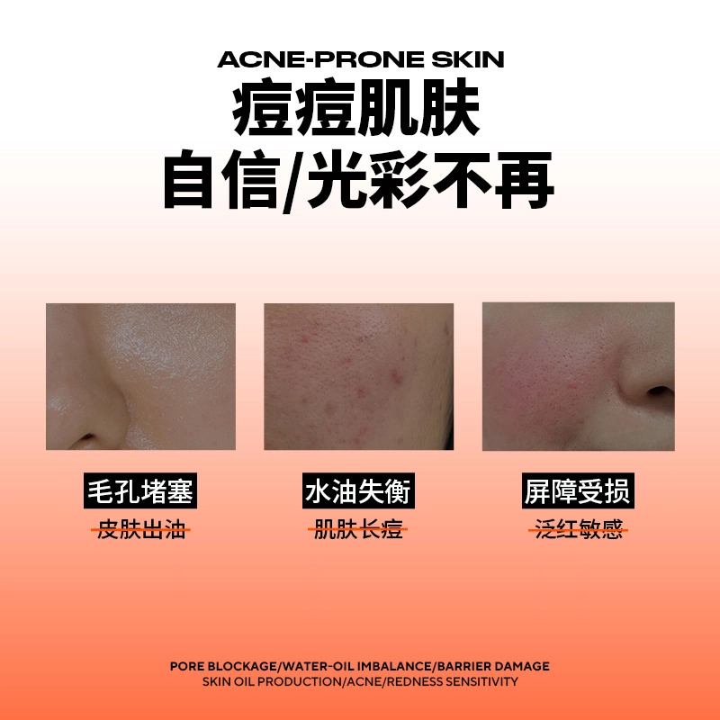 马丁 祛痘精华套装 舒缓紧致保湿补水清洁