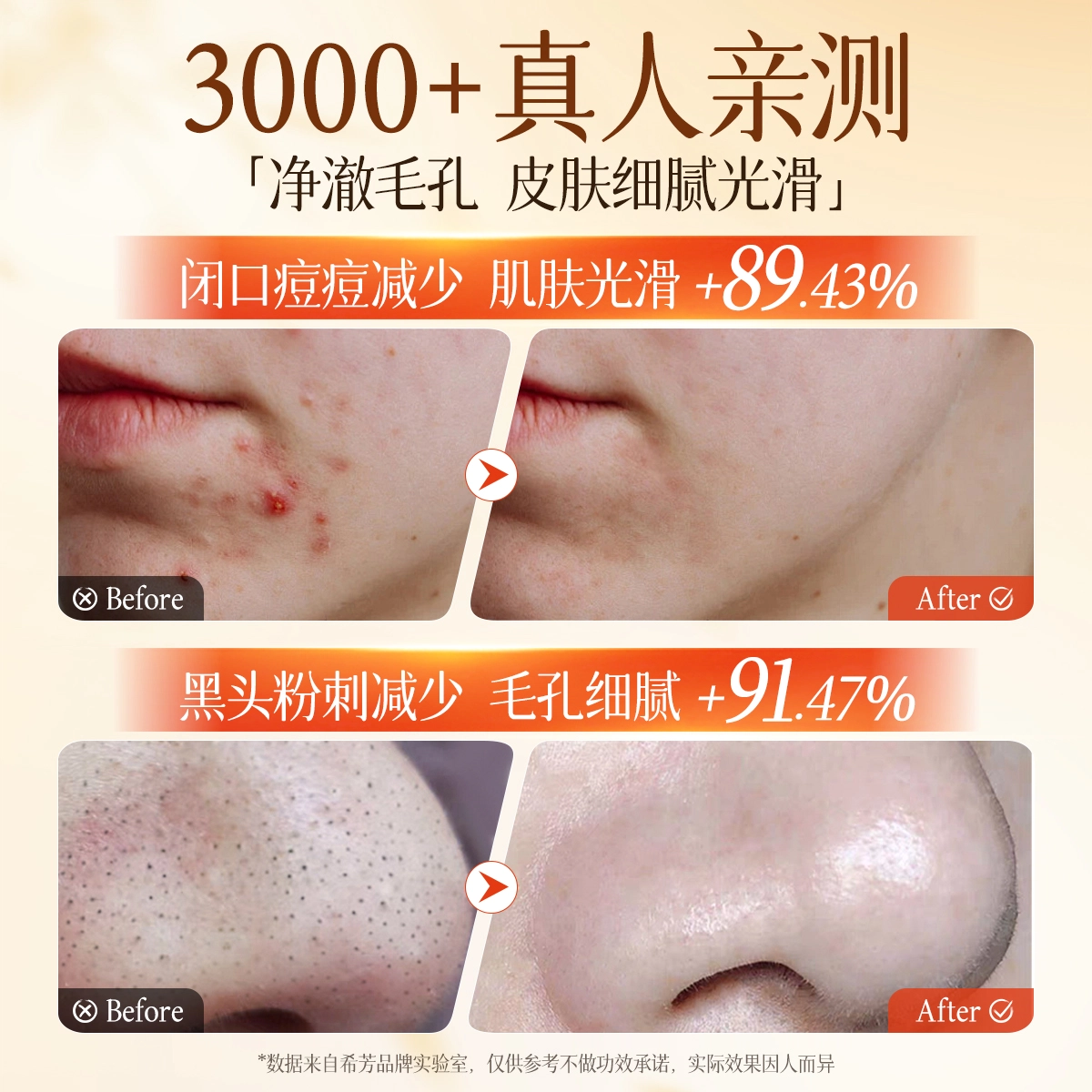 selfond 100g