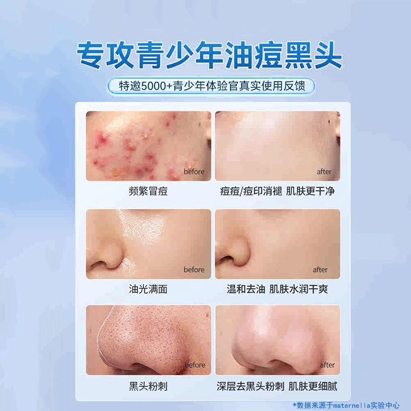 子初 青少年专用水乳洁面泥膜精华油痘肌护肤套装 保湿滋润补水控油清洁