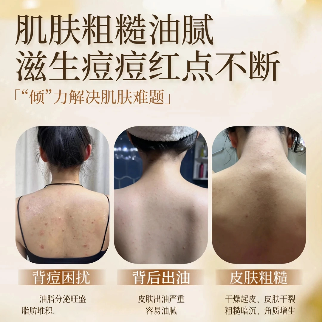 倾颜 护肤套装 硫磺苦参控油净颜 保湿去角质去黑头控油提亮清洁清爽祛痘紧致补水