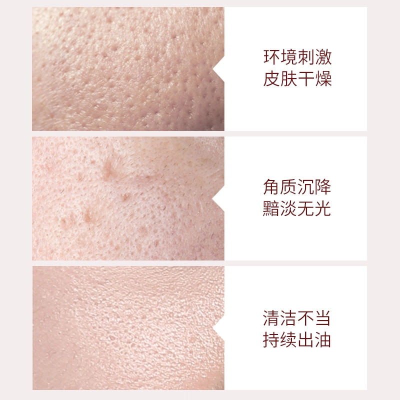 雪完美 氨基酸 活力控油洁面乳 清爽去角质清洁