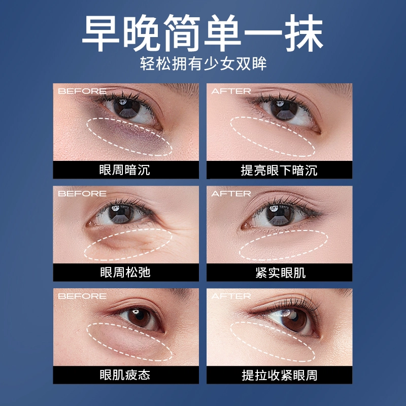 亚玛莉莎 玻色因淡化细纹眼霜 去黑眼圈抗皱提拉紧致改善眼部暗沉改善眼部浮肿淡纹紧致 淡化鱼尾纹去眼袋