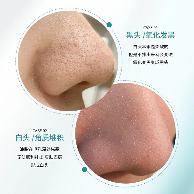 150ml