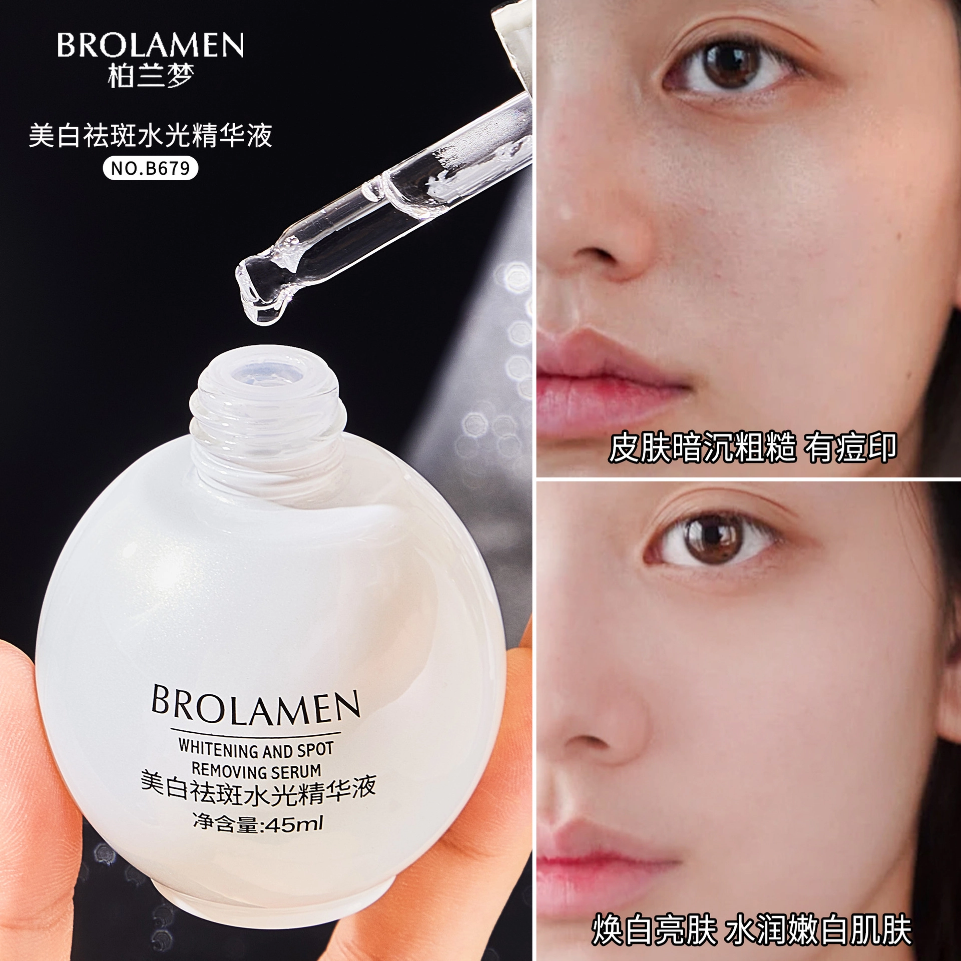 BROLAMEN