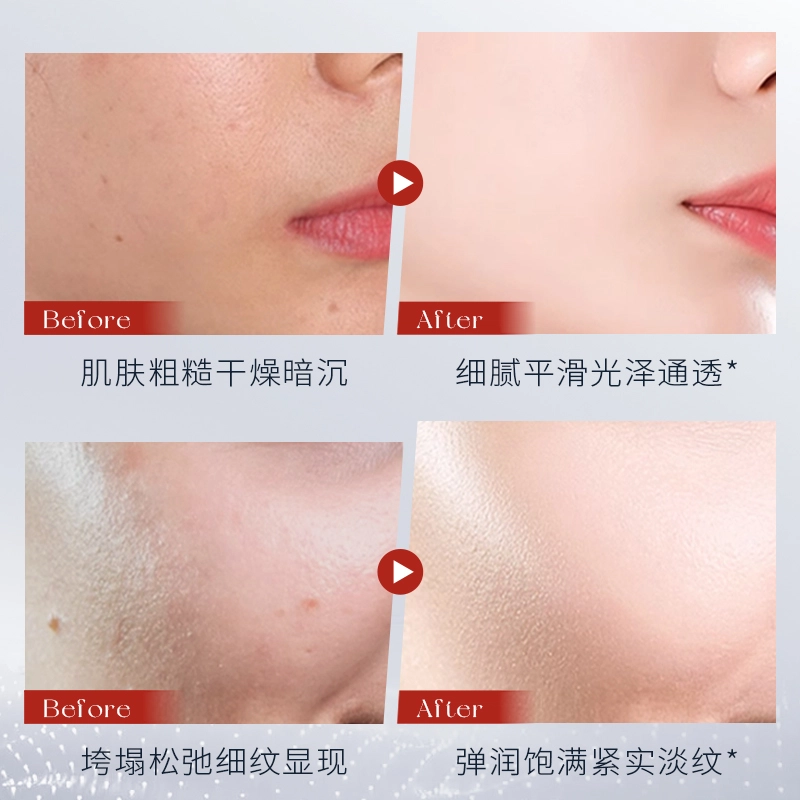 30ml